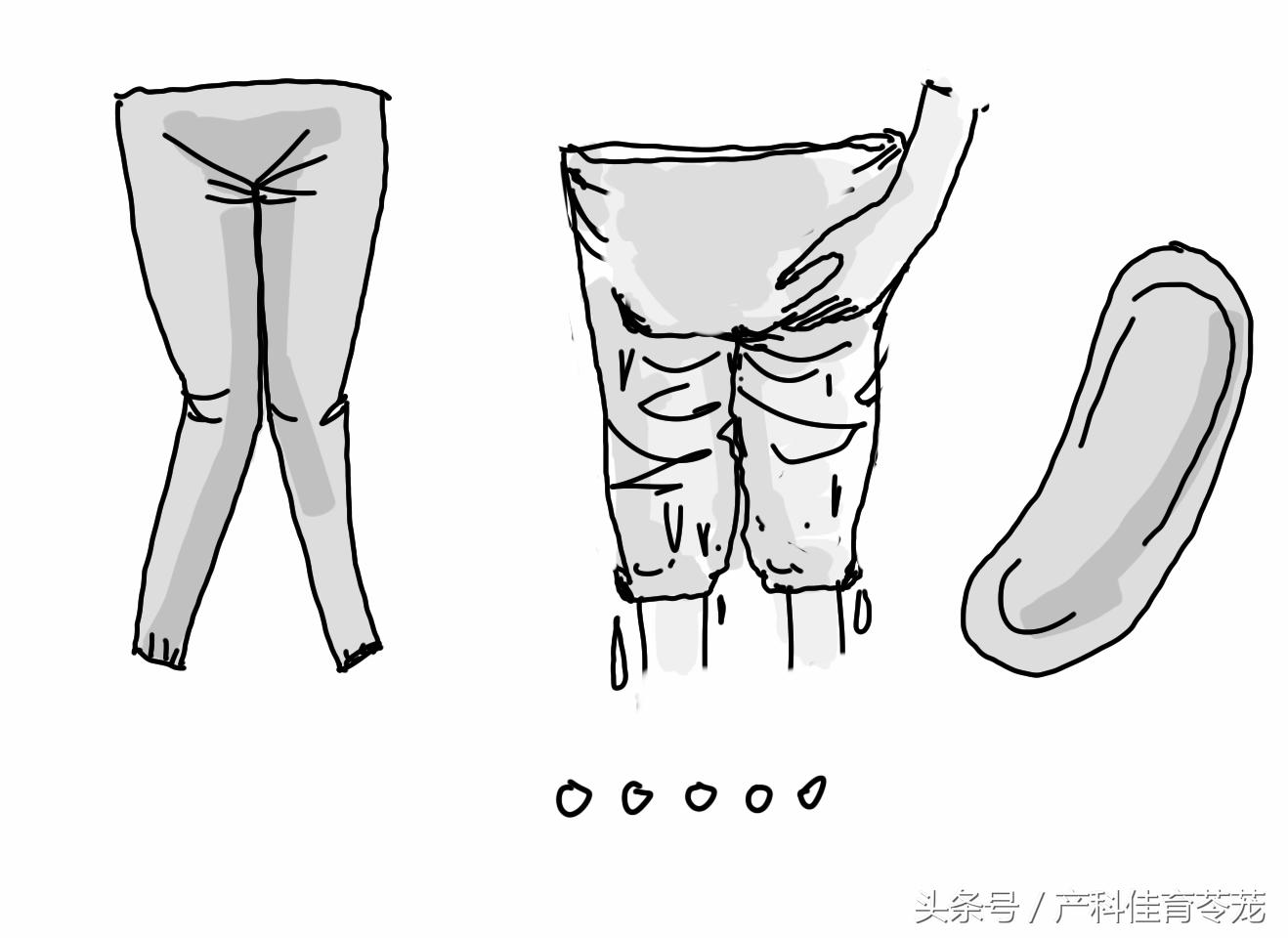 顽固性外阴瘙痒治不好了吧,不明原因的外阴瘙痒怎么办