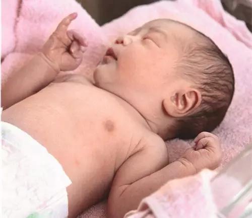 新生儿脐带护理消毒顺序,宝宝脐带消毒图解步骤