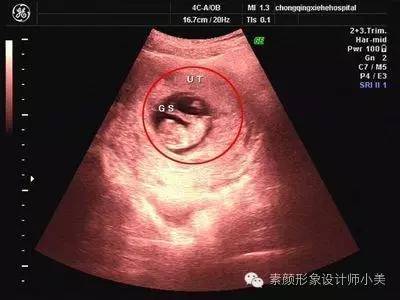 孕育课堂:怀孕八周胎儿发育与孕妈变化