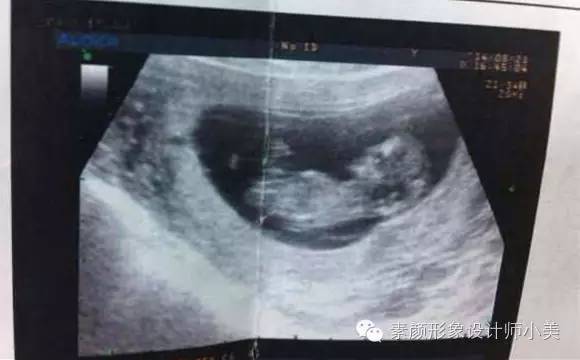 孕育课,孕育课堂