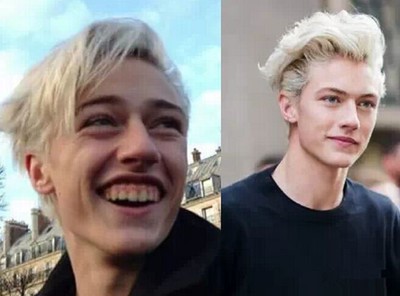 一笑就露牙龈很丑怎么办,笑起来不好看露牙龈怎么办