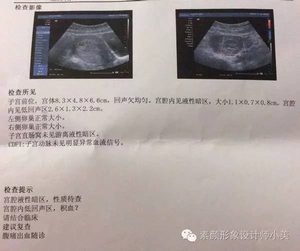 孕育宝宝整个过程和母体的变化,怀孕每周胎儿发育图及注意事项