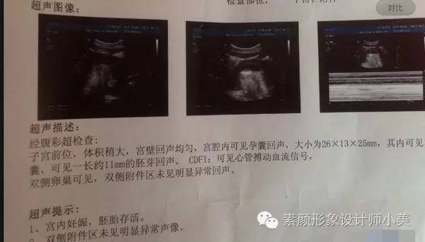 孕育小课堂,孕育课