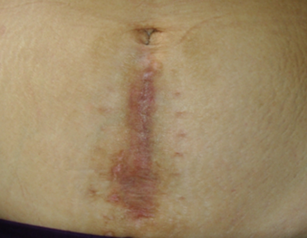 产后后遗症这么多，宝妈最不能忍受的是这一种