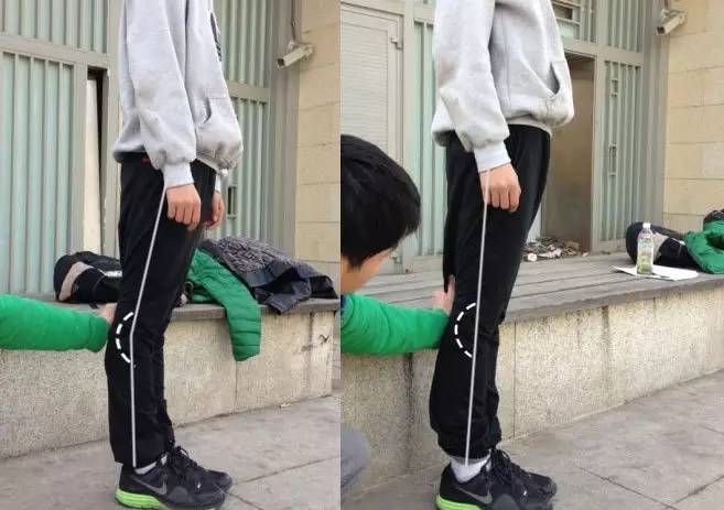 关节超伸,膝关节超伸训练动作