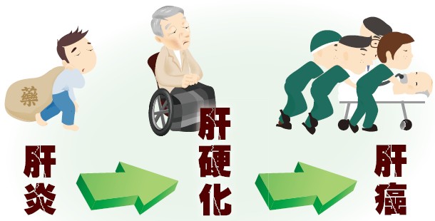 乙肝检查245阳性还会传染乙肝吗,乙肝会传染吗乙肝病人有哪些症状