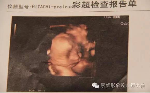 孕育课堂宝宝早期干预指导,孕育宝宝1-36周过程动画