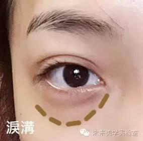 眼袋黑眼圈泪沟法令纹怎么遮瑕,遮瑕黑眼圈眼袋泪沟明星同款