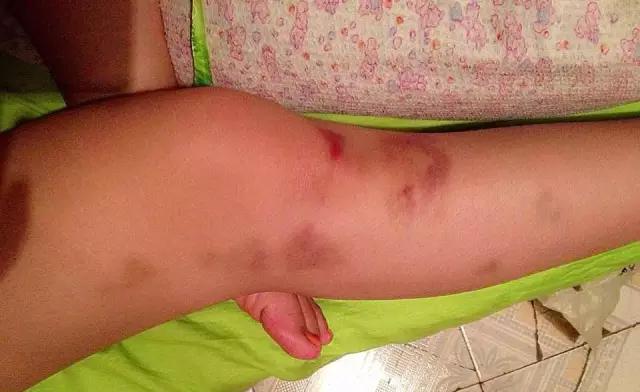 一团暴烈炽热的花火-足球运动员何昕芮|代言云南最大足球赛事!