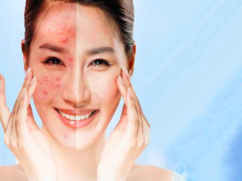 皮肤有点薄激素脸怎么护理,激素脸护理视频教程