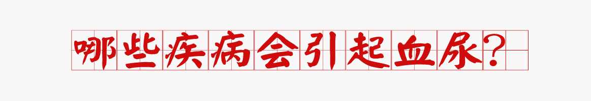 血尿病有多恐怖,肉眼血尿和镜下血尿常见疾病