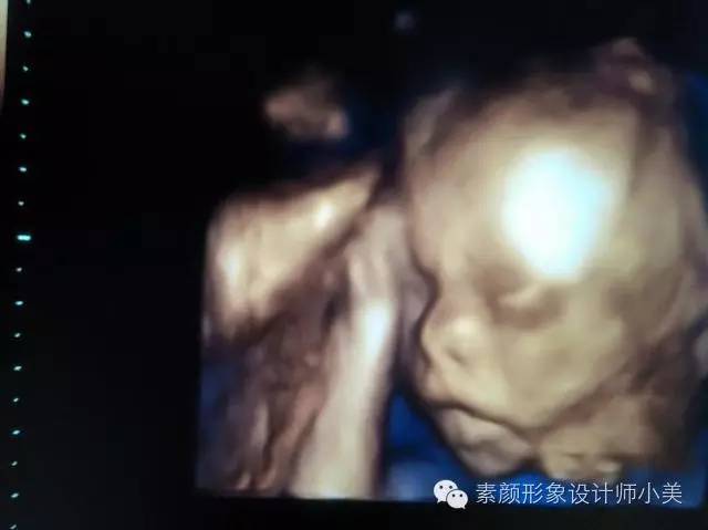 孕育课堂宝宝早期干预指导,孕育宝宝1-36周过程动画