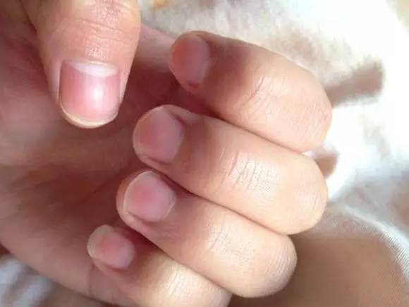 姿势|家有万金,难买这张表,为了家人请收藏好!