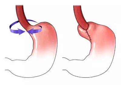 同仁医院眼整形,同仁医院眼睑下垂专家排名
