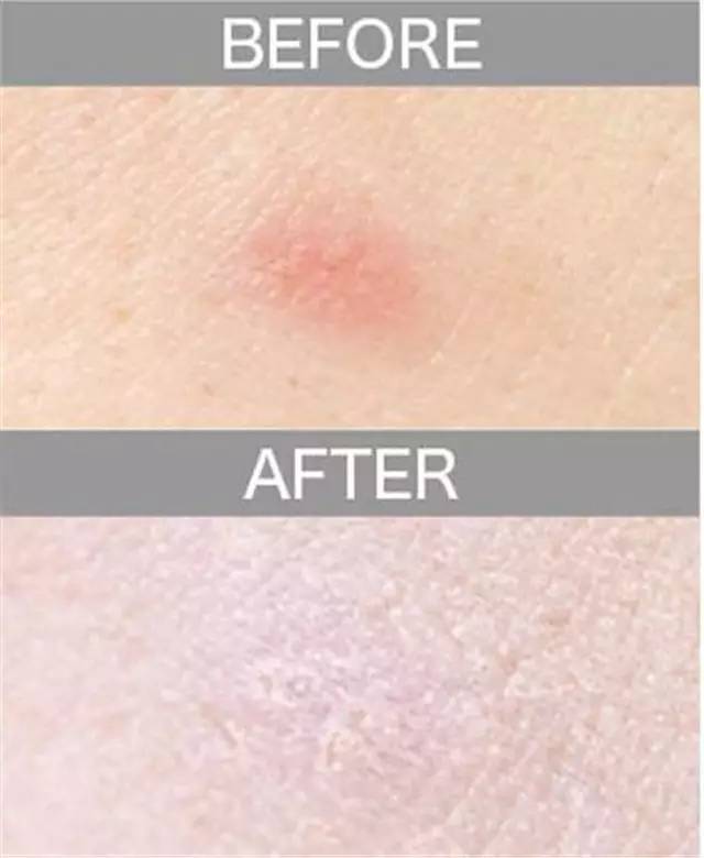 遮瑕膏排行榜10强混合皮肤,比较不错的三色遮瑕膏推荐