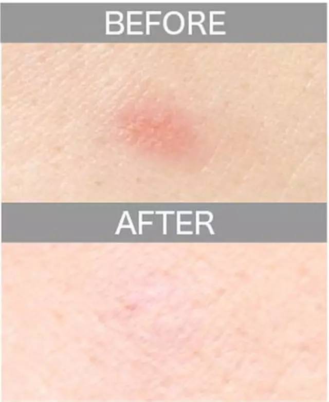 遮瑕膏排行榜10强混合皮肤,比较不错的三色遮瑕膏推荐