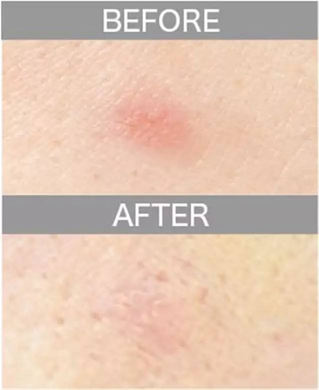 遮瑕膏排行榜10强混合皮肤,比较不错的三色遮瑕膏推荐