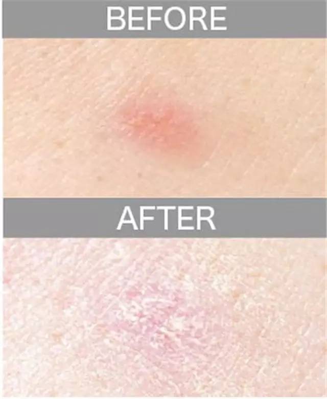 遮瑕膏排行榜10强混合皮肤,比较不错的三色遮瑕膏推荐