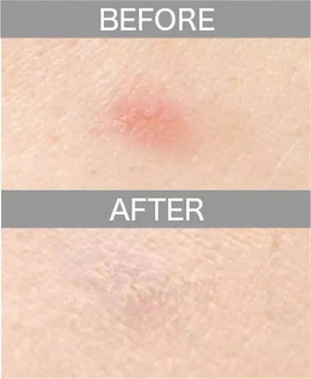 遮瑕膏排行榜10强混合皮肤,比较不错的三色遮瑕膏推荐