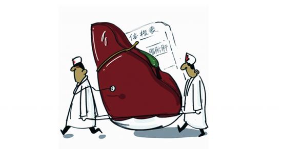 脂肪肝饭前运动还是饭后运动,脂肪肝有不吃药运动就能治愈的吗