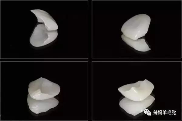 牙齿美白tips,变美第一步美白牙齿