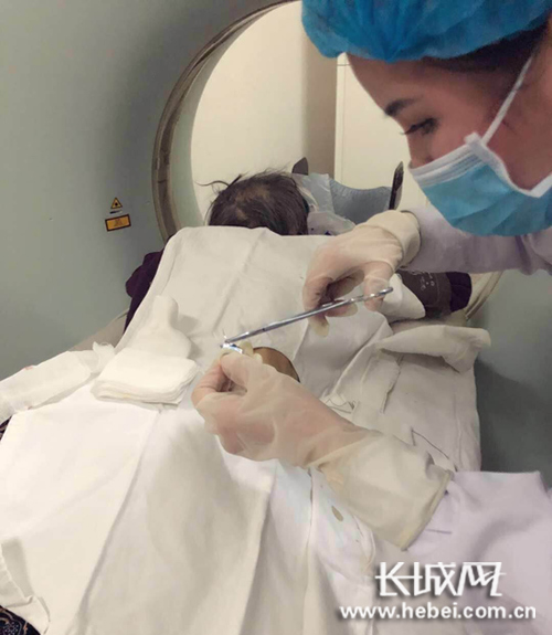 唐山市中医医院成功实施首例肾造瘘术填补技术空白