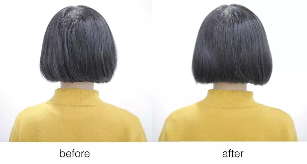 头皮屑多出油用什么牌子的洗发水,头油头皮屑掉发用什么洗发水