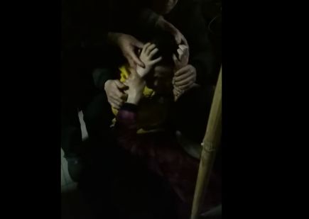 男子学狗叫咬人是狂犬病吗,门口狗叫引起男子狂犬病后续