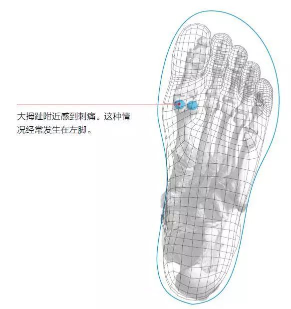 跑步脚趾盖疼怎么回事,跑步脚中间疼是骨裂吗