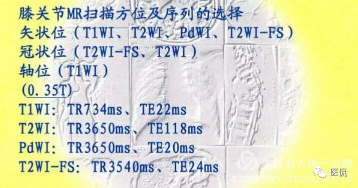 膝关节创伤性积脂血症的临床表现,创伤性积脂血症什么意思