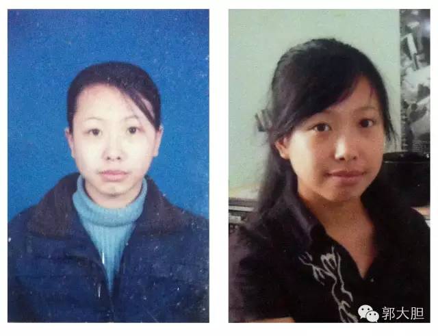 第一次整容日记,整容日记最经典的一段