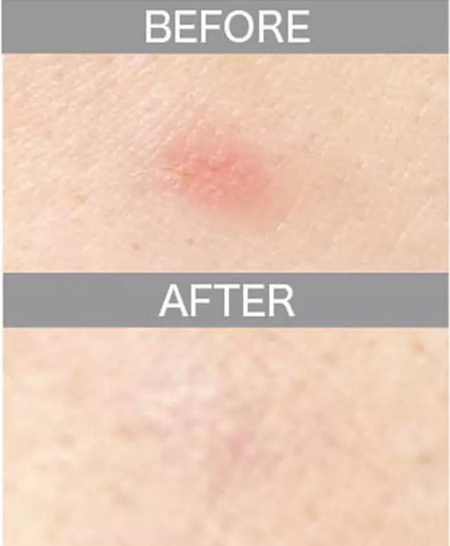 遮瑕膏排行榜10强混合皮肤,比较不错的三色遮瑕膏推荐