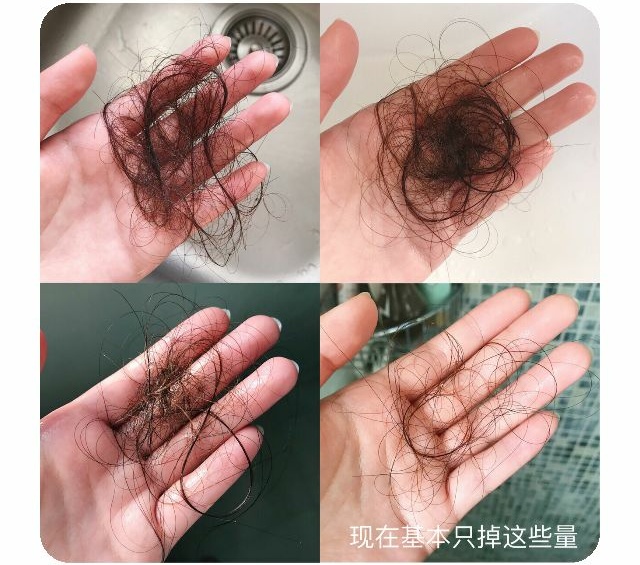 防脱发看完这篇就够了,亲测有效防脱发的护发小技巧