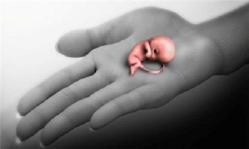 人工流产是怎样做的,人工流产最好的方法是什么