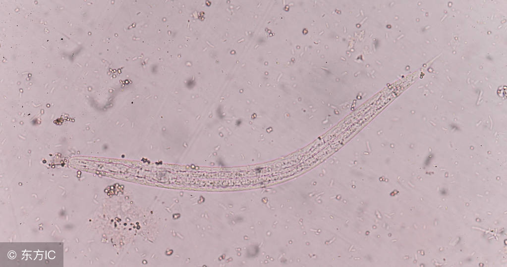 蛲虫病有什么症状,蛲虫病是怎么造成的