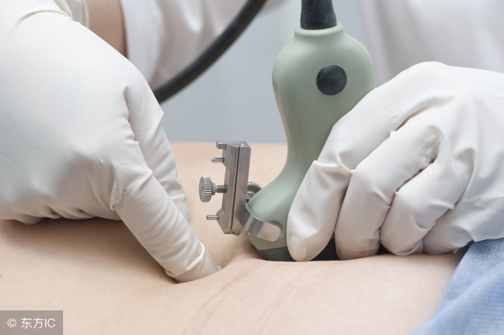 胃癌左锁骨淋巴结转移能活多久,胃癌浅表淋巴结转移