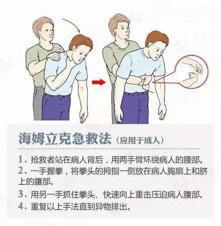 吃东西呛进气管该怎么办,吃饭时被食物呛入气管怎么办