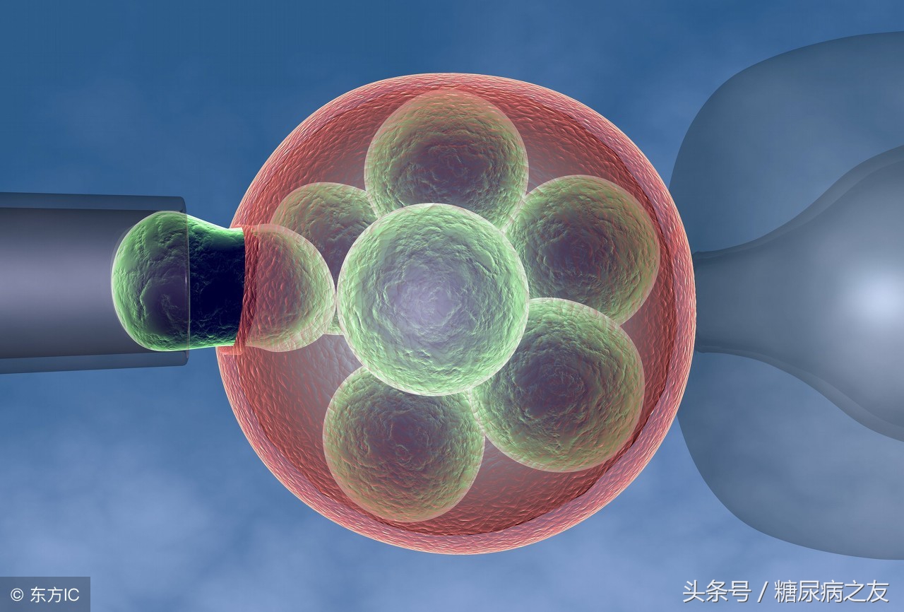 2022年干细胞移植治疗糖尿病进展,干细胞治疗糖尿病是真的吗