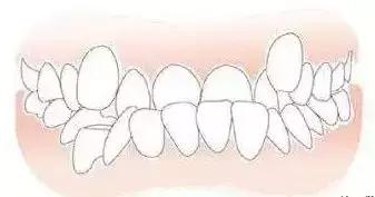阜阳市第九人民医院看牙怎么样,阜阳医院看牙费用