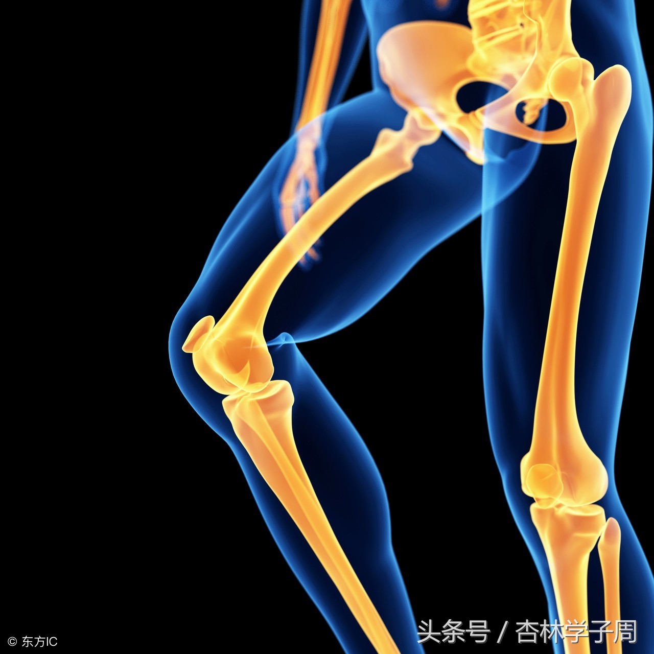 尿毒症会引起腿痛吗,尿毒症会引起腰疼腿疼吗