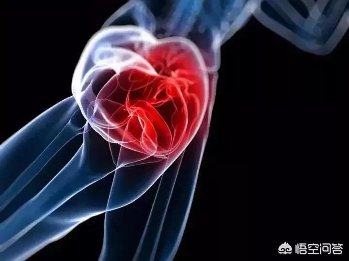 伤筋动骨真的需要休息一百天吗,伤筋动骨100天正确吗