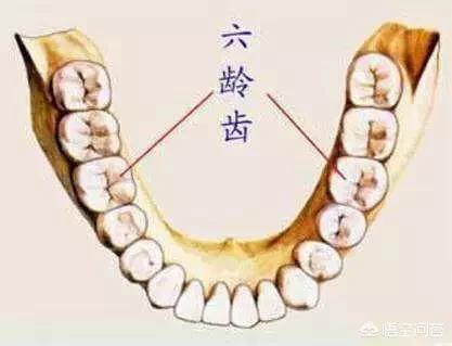 牙齿坏了一半应该补还是做牙冠,儿童要换的牙齿坏了需要补吗