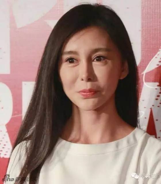 第一次整容日记,整容日记最经典的一段