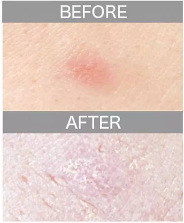 遮瑕膏排行榜10强混合皮肤,比较不错的三色遮瑕膏推荐