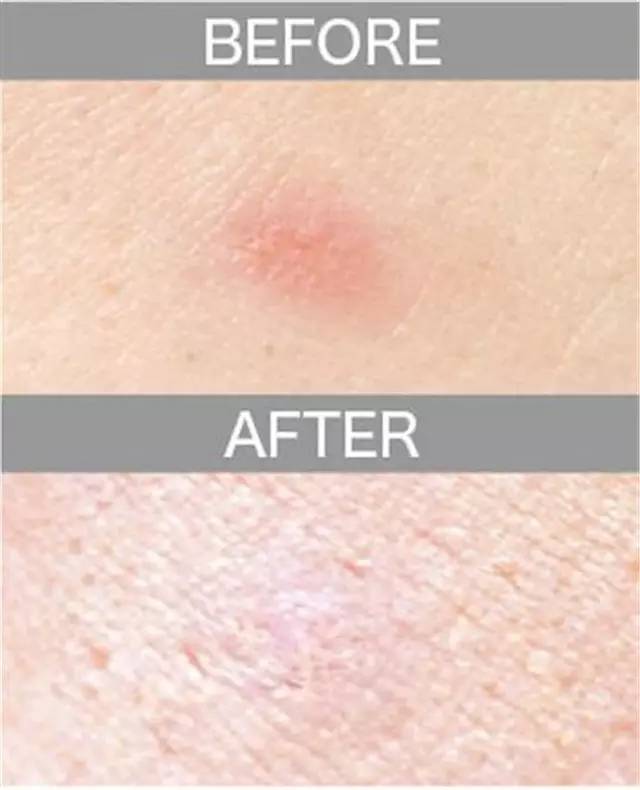 遮瑕膏排行榜10强混合皮肤,比较不错的三色遮瑕膏推荐