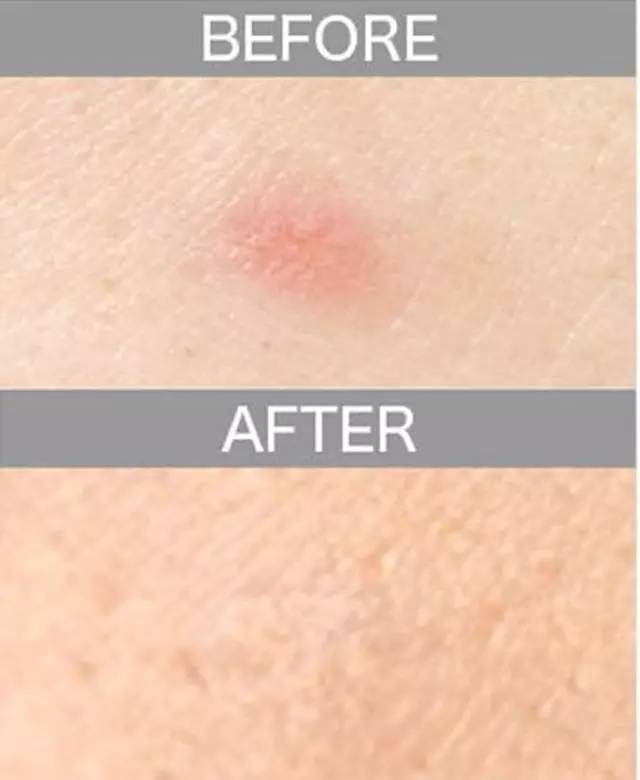 遮瑕膏排行榜10强混合皮肤,比较不错的三色遮瑕膏推荐