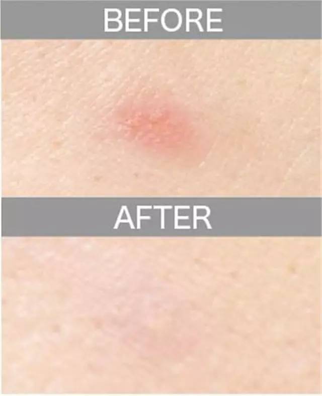 遮瑕膏排行榜10强混合皮肤,比较不错的三色遮瑕膏推荐