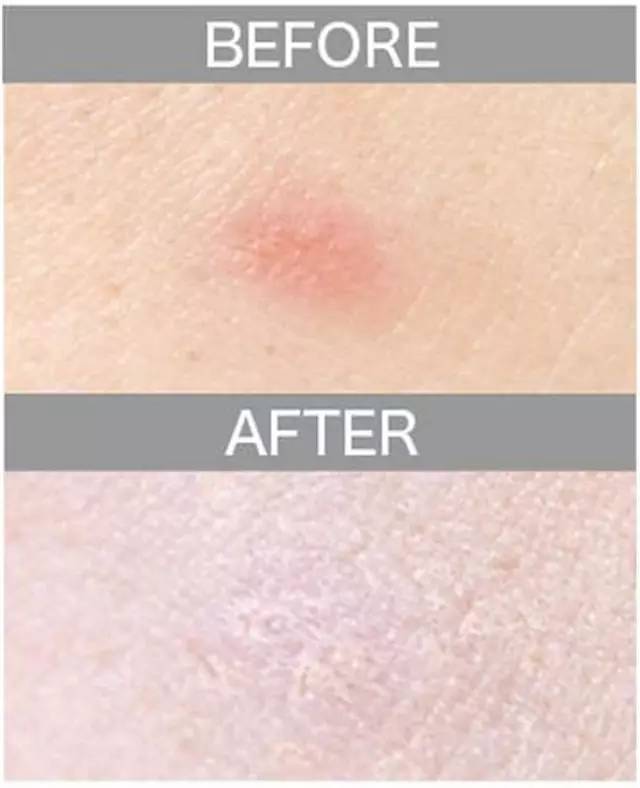 遮瑕膏排行榜10强混合皮肤,比较不错的三色遮瑕膏推荐