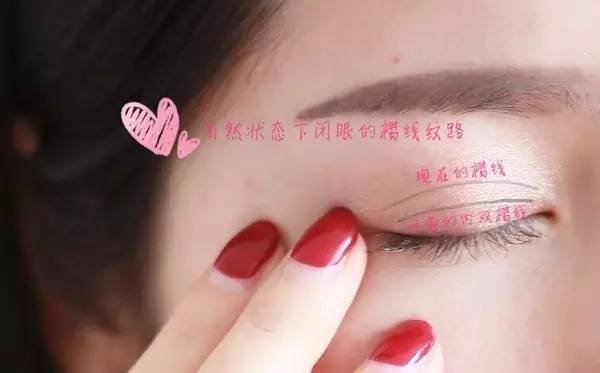 内双适合什么样的双眼皮贴,如何让内双眼皮变成双眼皮