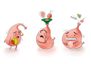 奥美拉唑碳酸氢钠干混悬剂治胃疼,胃酸过多用奥美拉唑还是碳酸氢钠